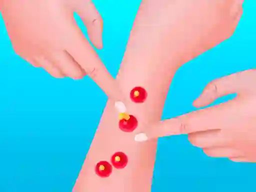 لعبة Pimple Poper Rush على الانترنت