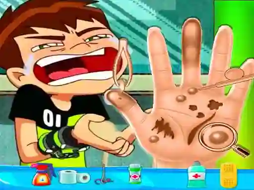 لعبة Ben10 Hand Doctor على الانترنت